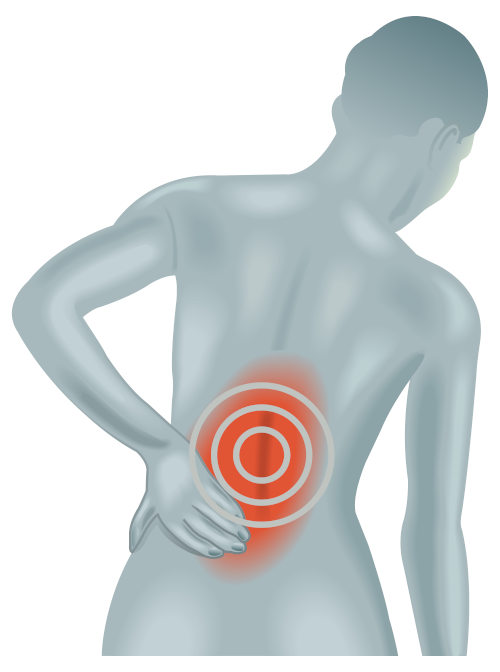 EMS Training hilft gegen Rückenschmerzen.